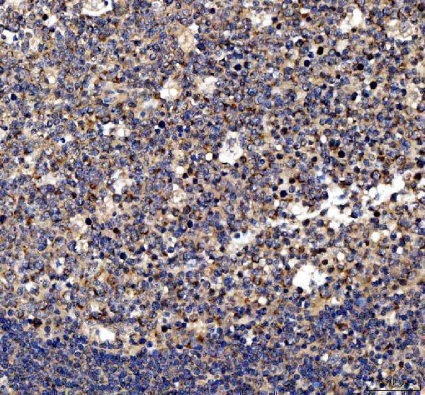 IHC analysis of MYD88 using anti-MYD88 antibody (PA1660)