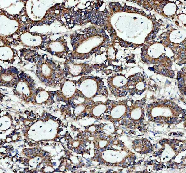 IHC analysis of MYD88 using anti-MYD88 antibody (PA1660)