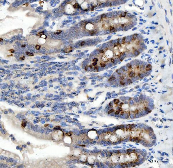  IHC analysis of NOX1 using anti-NOX1 antibody (PA1666)