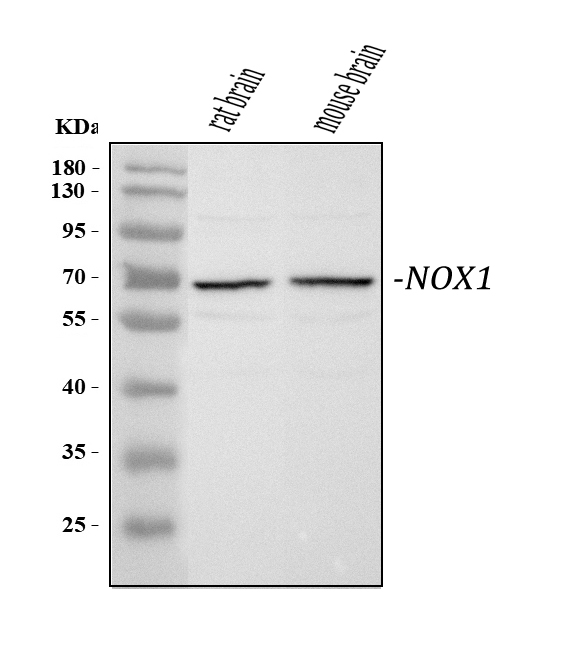  Western blot analysis of NOX1 using anti-NOX1 antibody (PA1666)