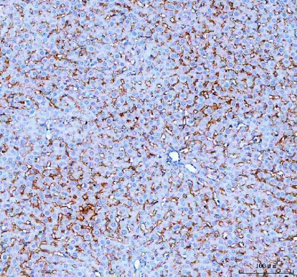 pa1670 slc10a1 primary antibodies ihc testing 3