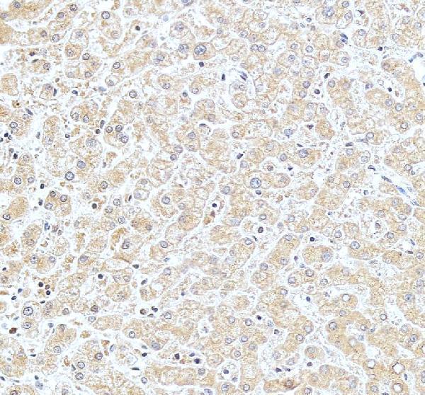 pa1670 slc10a1 primary antibodies ihc testing 4_1
