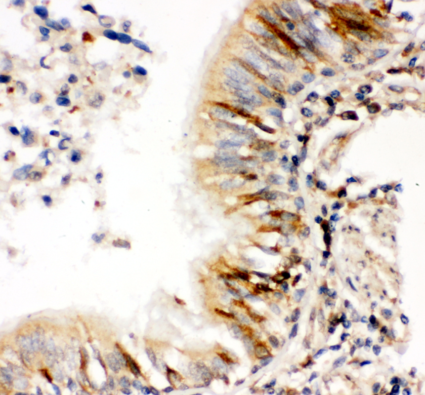 IHC analysis of PDIA3 using anti-PDIA3 antibody (PA1679)