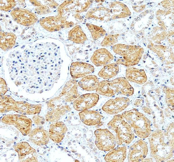 pa1683 slc22a6 primary antibodies ihc testing 4