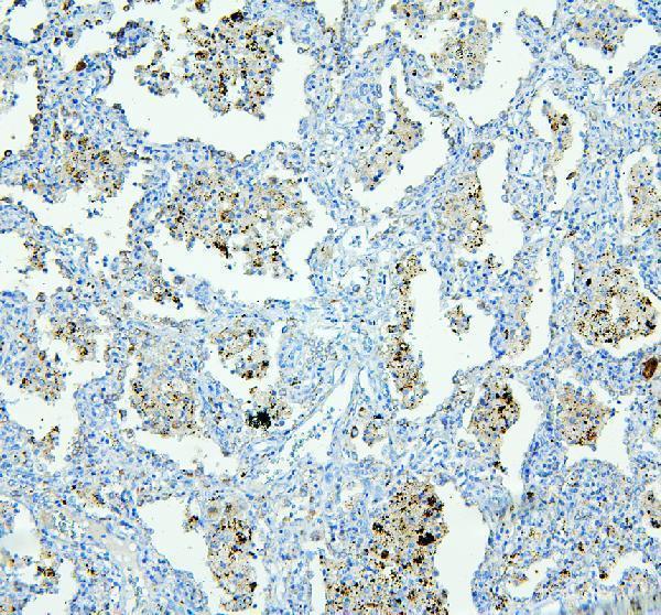 pa1687 nlrp4g primary antibodies ihc testing 2