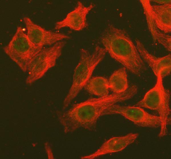 IF analysis of STAT6 using anti-STAT6 antibody (PA1691) and anti-Tubulin Alpha antibody (M03989-3)