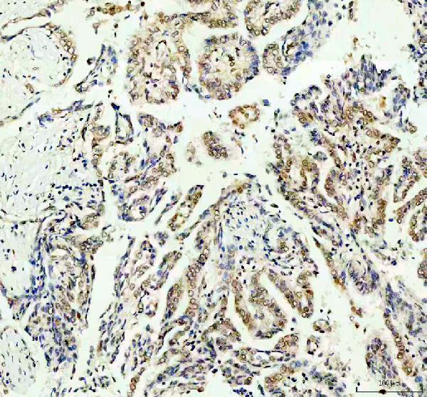 IHC analysis of STAT6 using anti-STAT6 antibody (PA1691)