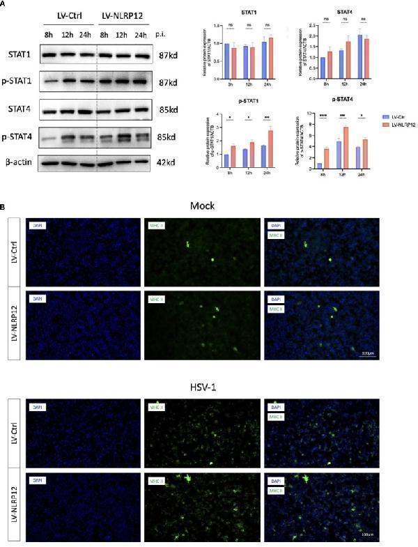 NLRP12 enhances antiviral functions through IL-18 downstream JAK-STAT signaling
