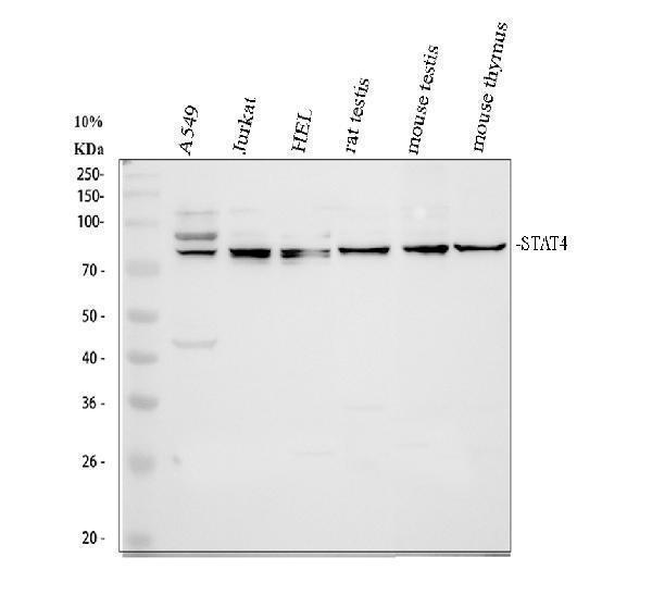 Western blot analysis of STAT4 using anti-STAT4 antibody (PA1692)