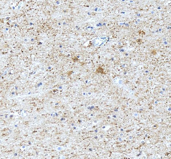 IHC analysis of Tenascin-R/TNR using anti-Tenascin-R/TNR antibody (PA1695)