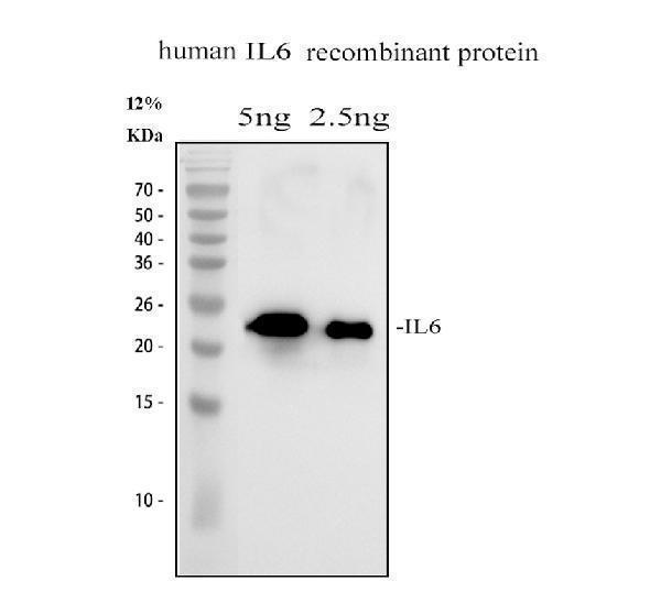 Western blot analysis of IL6 using anti-IL6 antibody (PA1700)