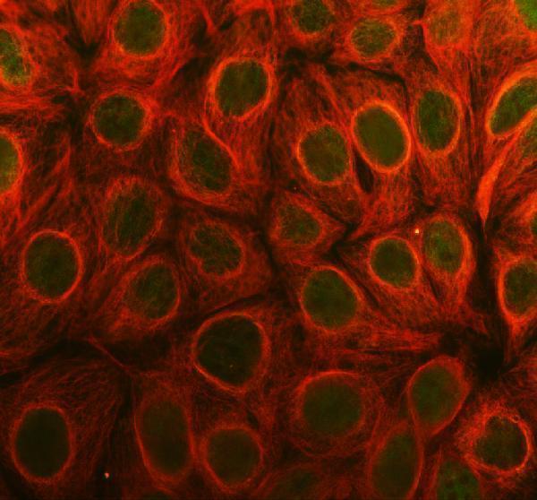 IF analysis of PAK6 using anti-PAK6 antibody (PA1729) and anti-Tubulin Alpha antibody (M03989-3)