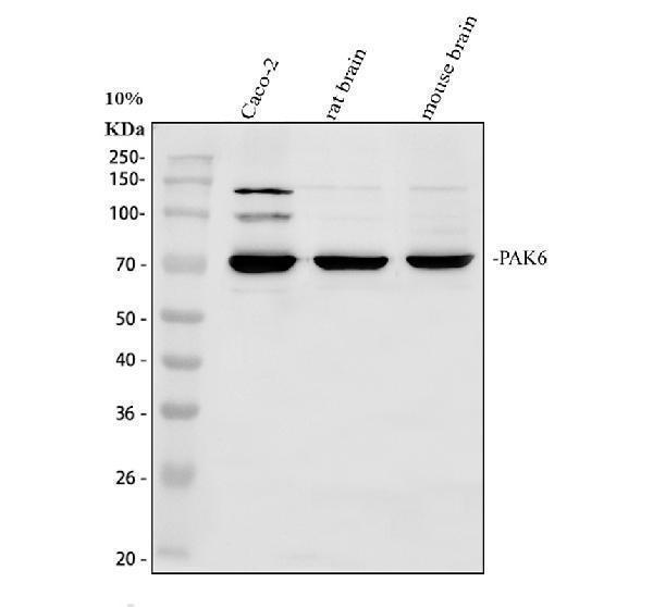 Western blot analysis of PAK6 using anti-PAK6 antibody (PA1729)