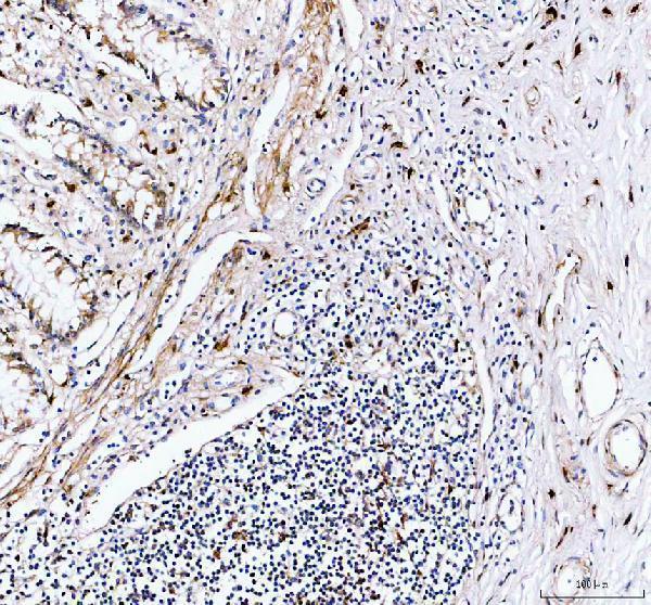 pa1738 gzmb primary antibodies ihc testing 1