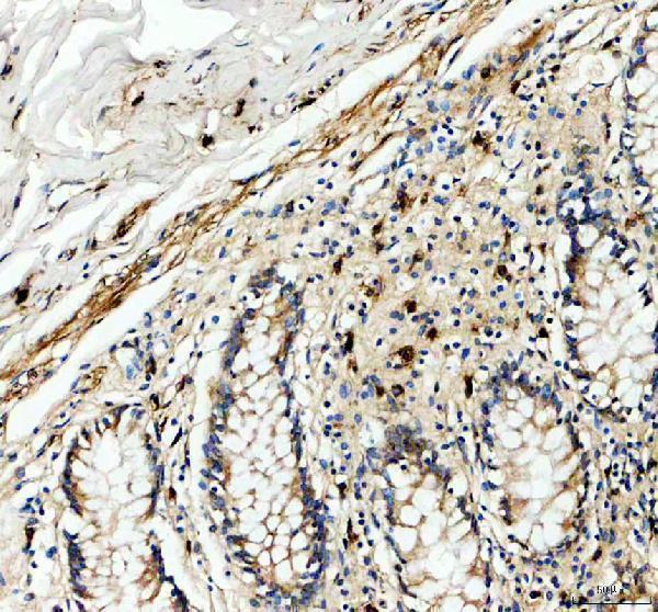 pa1738 gzmb primary antibodies ihc testing 2