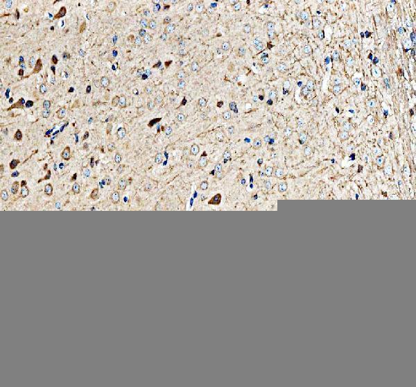 pa1741 alk primary antibodies ihc testing 1
