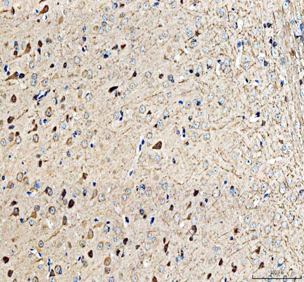 pa1741 alk primary antibodies ihc testing 1_1