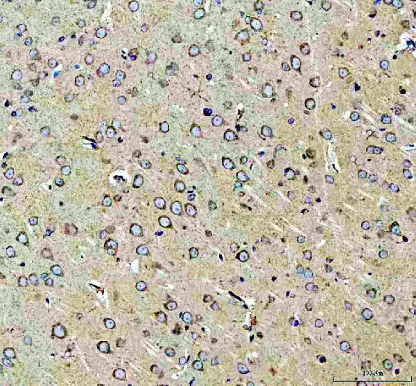 pa1741 alk primary antibodies ihc testing 2