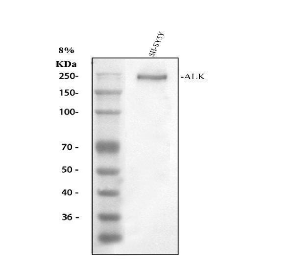 pa1741 alk primary antibodies wb testing 1