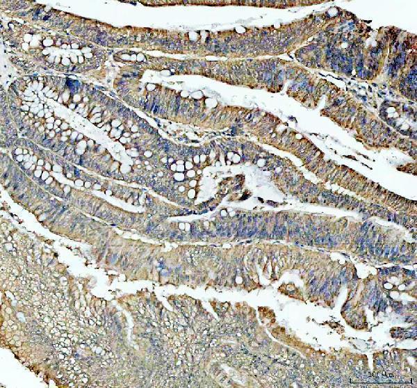 IHC analysis of IGF1R using anti-IGF1R antibody (PA1746)