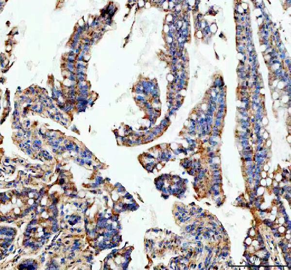 IHC analysis of IGF1R using anti-IGF1R antibody (PA1746)