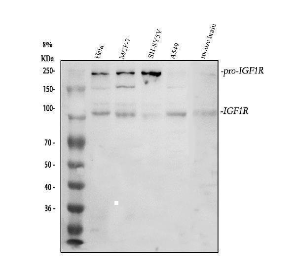 Western blot analysis of IGF1R using anti-IGF1R antibody (PA1746)