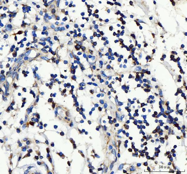 pa1747 il2ra primary antibodies ihc testing 2