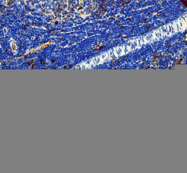 IHC analysis of IL3 using anti-IL3 antibody (PA1748)