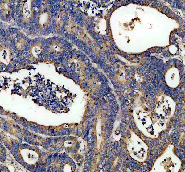 pa1763 eci1 primary antibodies ihc testing 1