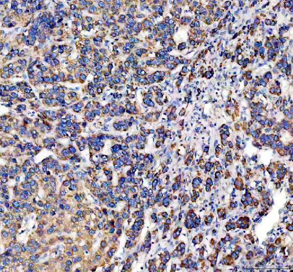 pa1763 eci1 primary antibodies ihc testing 2