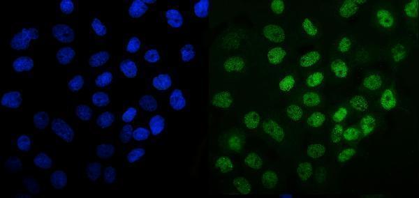 pa1769 mcm6 primary antibodies if testing 8