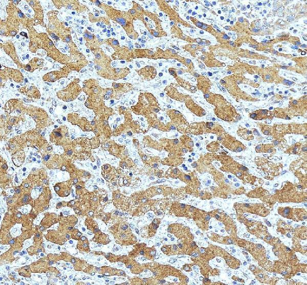 IHC analysis of RAB5A using anti-RAB5A antibody (PA1773)