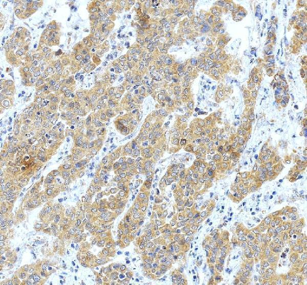 pa1773 rab5a primary antibodies ihc testing 4