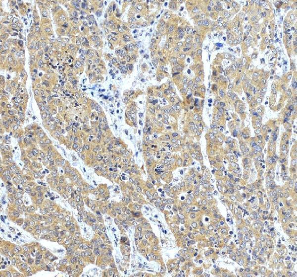 pa1773 rab5a primary antibodies ihc testing 5