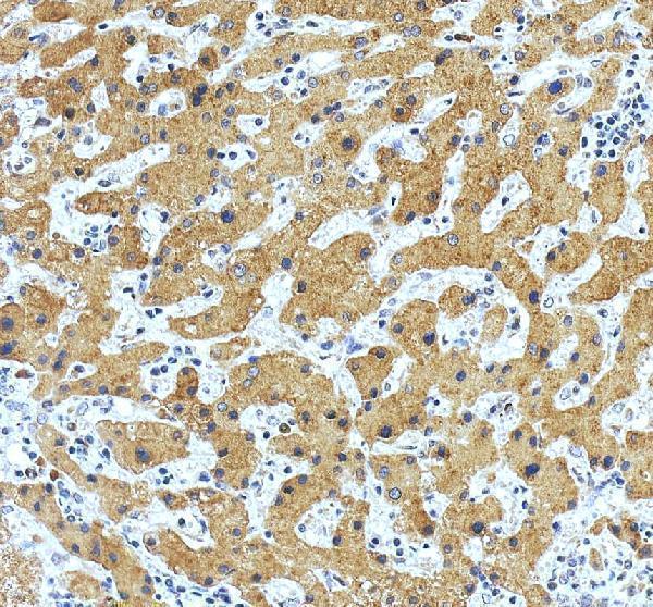 pa1773 rab5a primary antibodies ihc testing 6