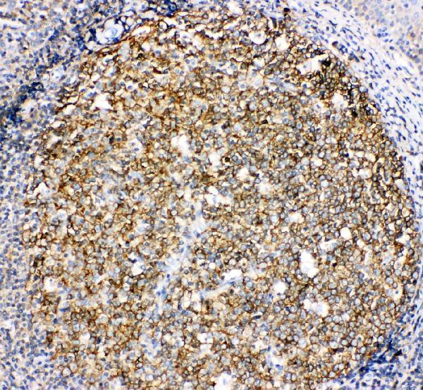 pa1774 snap23 primary antibodies ihc testing 6