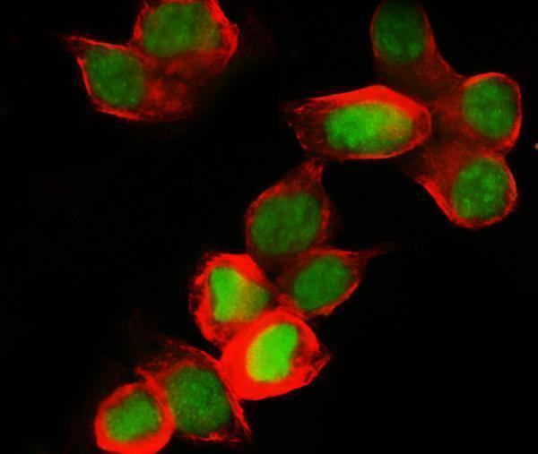 pa1792 mcm7 primary antibodies if testing 5