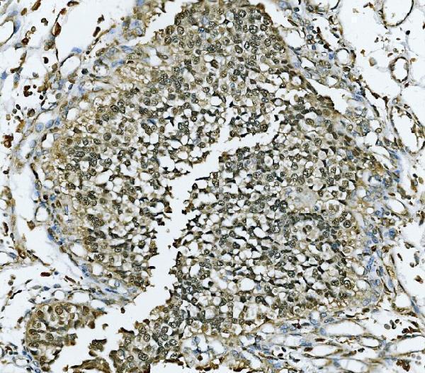 pa1792 mcm7 primary antibodies ihc testing 2