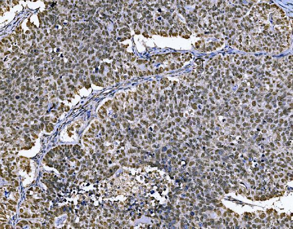 pa1792 mcm7 primary antibodies ihc testing 3