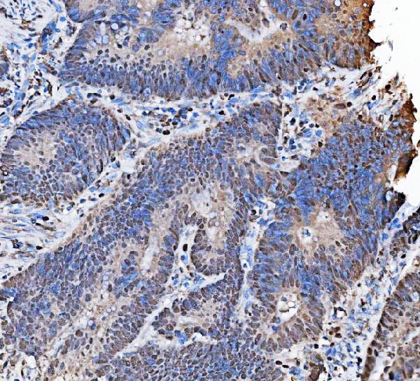 pa1792 mcm7 primary antibodies ihc testing 4