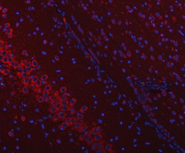 pa1796 ssr3 primary antibodies if testing 11