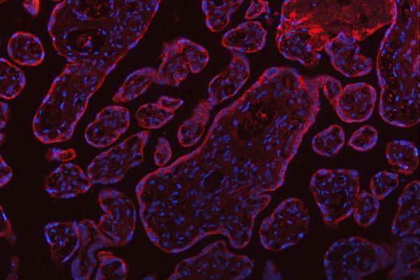 pa1796 ssr3 primary antibodies if testing 12