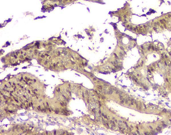 pa1797 sfn primary antibodies ihc testing 2