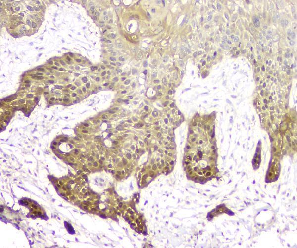 pa1797 sfn primary antibodies ihc testing 4