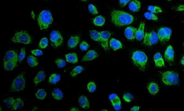 pa1804 pxn primary antibody if testing 5