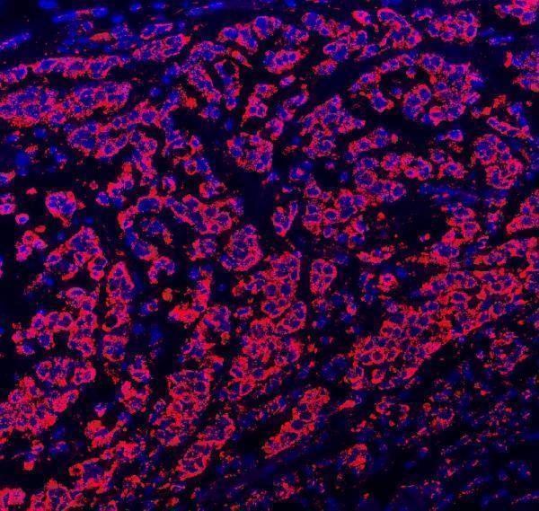 pa1804 pxn primary antibody if testing 7