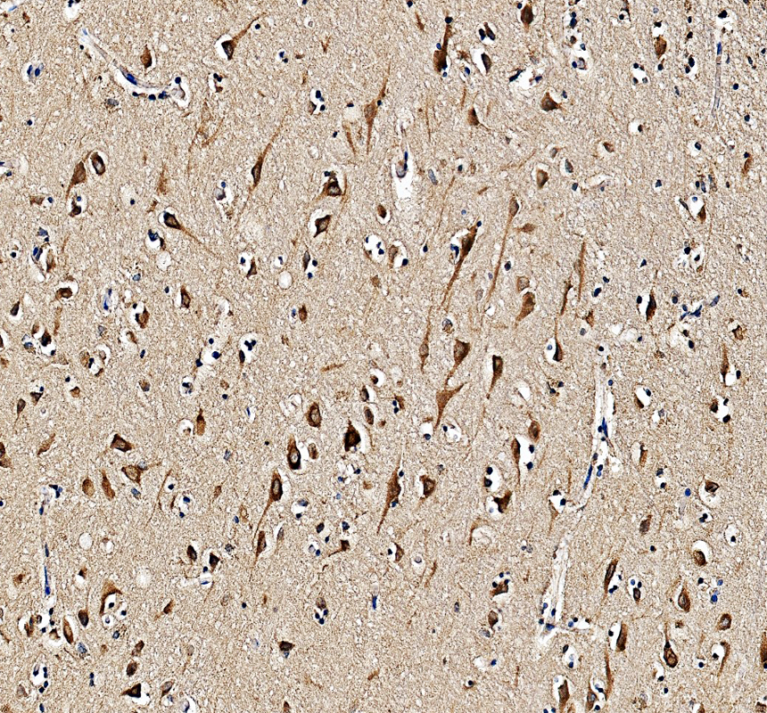 IHC analysis of HSPA5 using anti-HSPA5 antibody (PA1815)