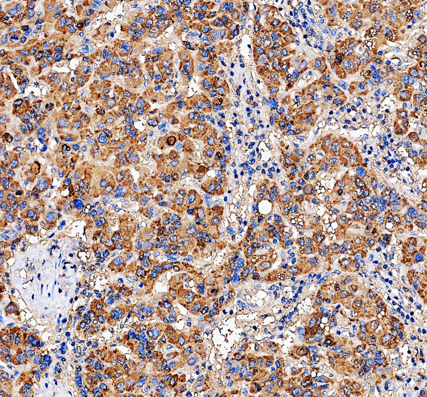 pa1815 hspa5 primary antibodies ihc testing 2