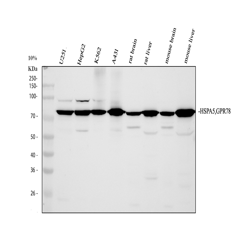 Western blot analysis of HSPA5 using anti-HSPA5 antibody (PA1815)