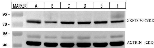 pa1815 hspa5 primary antibodies wb testing 1_1